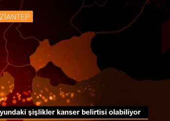 Boyundaki şişlikler kanser belirtisi olabiliyor