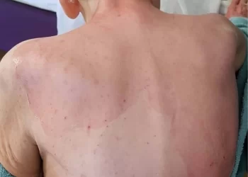 Yaşlı Bakımevindeki Kadının Ölümüyle İlgili Rapor Mahkemeye Ulaştı